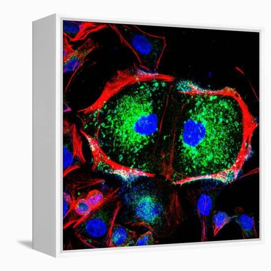 Dividing Cell, Light Micrograph-Science Photo Library-Framed Premier Image Canvas