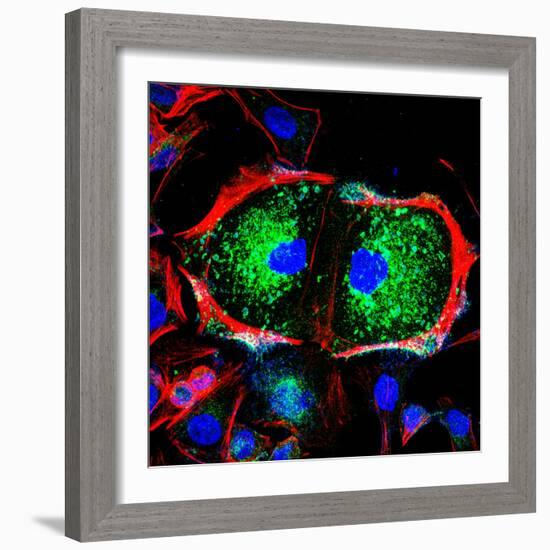 Dividing Cell, Light Micrograph-Science Photo Library-Framed Premium Photographic Print