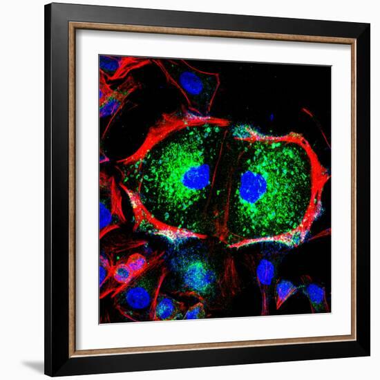 Dividing Cell, Light Micrograph-Science Photo Library-Framed Premium Photographic Print