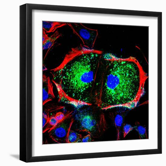 Dividing Cell, Light Micrograph-Science Photo Library-Framed Premium Photographic Print