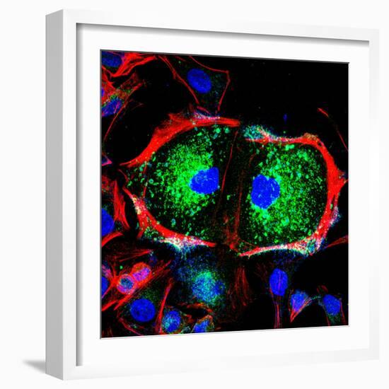 Dividing Cell, Light Micrograph-Science Photo Library-Framed Premium Photographic Print