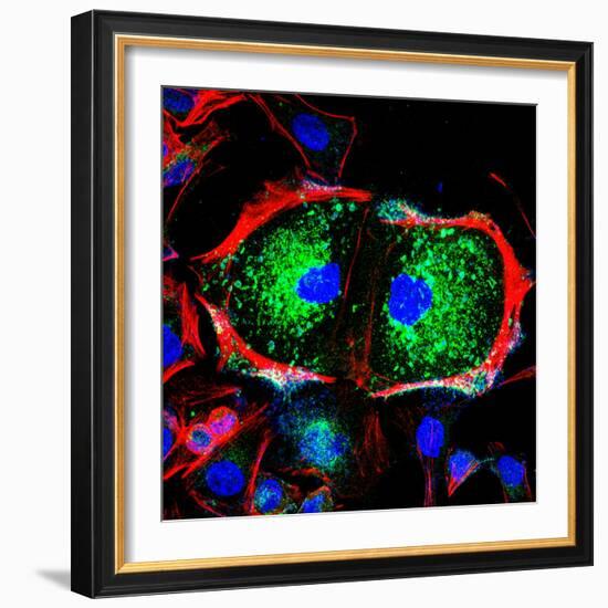 Dividing Cell, Light Micrograph-Science Photo Library-Framed Premium Photographic Print