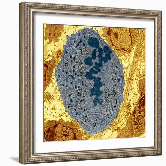 Dividing Sarcoma Cancer Cell, TEM-Steve Gschmeissner-Framed Premium Photographic Print