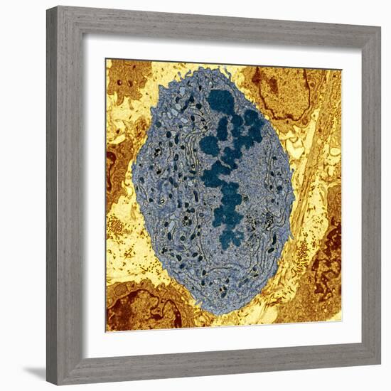 Dividing Sarcoma Cancer Cell, TEM-Steve Gschmeissner-Framed Premium Photographic Print