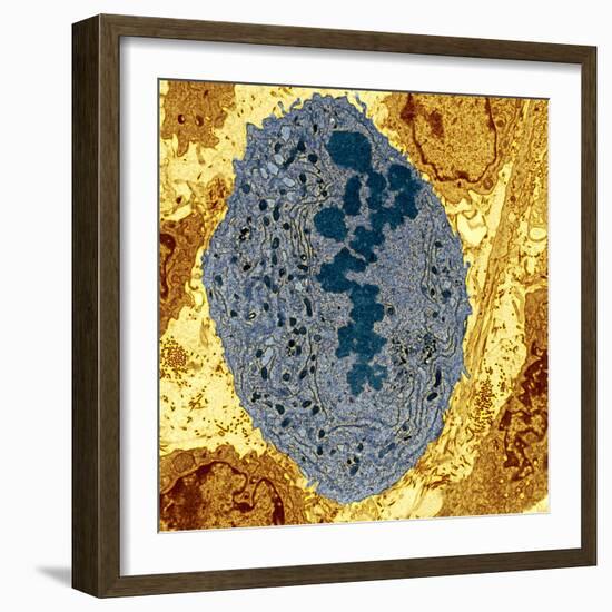 Dividing Sarcoma Cancer Cell, TEM-Steve Gschmeissner-Framed Premium Photographic Print