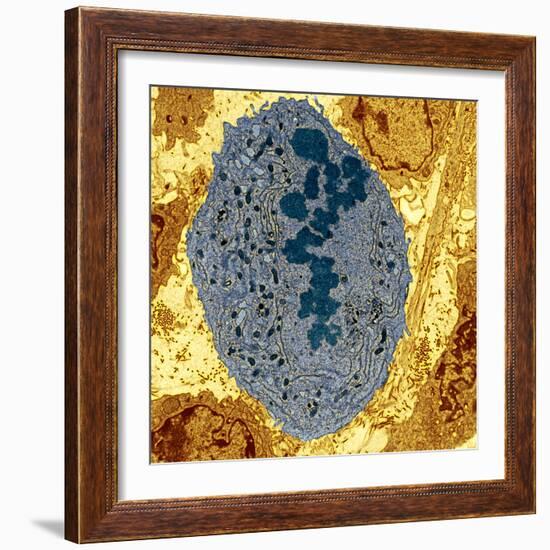 Dividing Sarcoma Cancer Cell, TEM-Steve Gschmeissner-Framed Premium Photographic Print