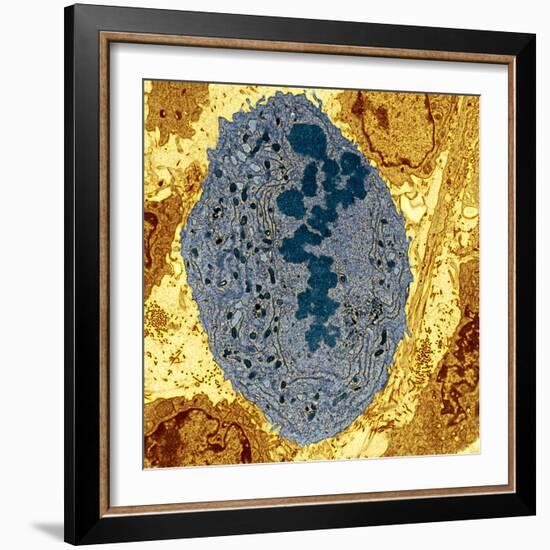 Dividing Sarcoma Cancer Cell, TEM-Steve Gschmeissner-Framed Premium Photographic Print