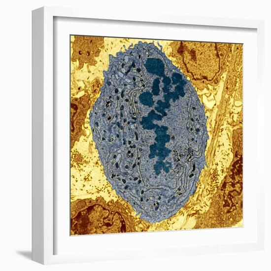 Dividing Sarcoma Cancer Cell, TEM-Steve Gschmeissner-Framed Premium Photographic Print