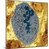 Dividing Sarcoma Cancer Cell, TEM-Steve Gschmeissner-Mounted Premium Photographic Print