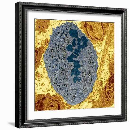 Dividing Sarcoma Cancer Cell, TEM-Steve Gschmeissner-Framed Premium Photographic Print