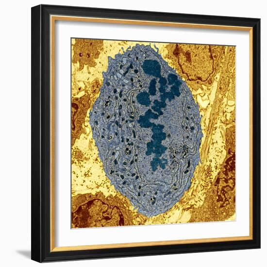 Dividing Sarcoma Cancer Cell, TEM-Steve Gschmeissner-Framed Premium Photographic Print