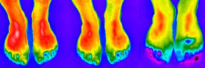 Thermogram of Feet-Dr. Arthur Tucker-Laminated Photographic Print