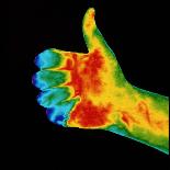 Thermogram of Feet-Dr. Arthur Tucker-Laminated Photographic Print