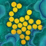 Polio Viruses, TEM-Dr. Linda Stannard-Framed Photographic Print