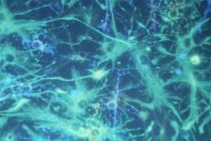 Brain Cells-Dr. Neal Scolding-Framed Premier Image Canvas