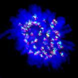 Cancer Cell Division-Dr. Paul Andrews-Framed Premium Photographic Print