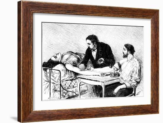 Dr Roussell of Geneva Giving a Woman a Direct Blood Transfusion from a Volunteer, 1882-null-Framed Giclee Print