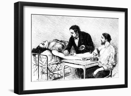 Dr Roussell of Geneva Giving a Woman a Direct Blood Transfusion from a Volunteer, 1882-null-Framed Giclee Print