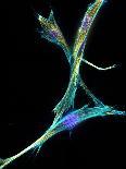 Lung Cells, Fluorescent Micrograph-Dr. Torsten Wittmann-Framed Premium Photographic Print