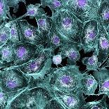 Lung Cells, Fluorescent Micrograph-Dr. Torsten Wittmann-Framed Photographic Print