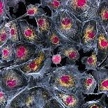 Lung Cells, Fluorescent Micrograph-Dr. Torsten Wittmann-Premium Photographic Print