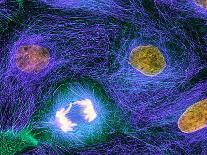 Fibroblast Cells, Fluorescent Micrograph-Dr. Torsten Wittmann-Photographic Print