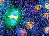 Fibroblast Cells Showing Cytoskeleton-Dr. Torsten Wittmann-Photographic Print