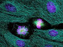 Fibroblast Cells Showing Cytoskeleton-Dr. Torsten Wittmann-Framed Photographic Print