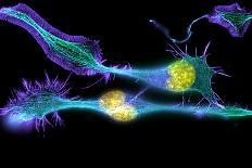 Nerve Cancer Cells, Light Micrograph-Dr. Torsten Wittmann-Photographic Print