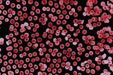 Red Blood Cells, SEM-Dr. Yorgos Nikas-Framed Photographic Print