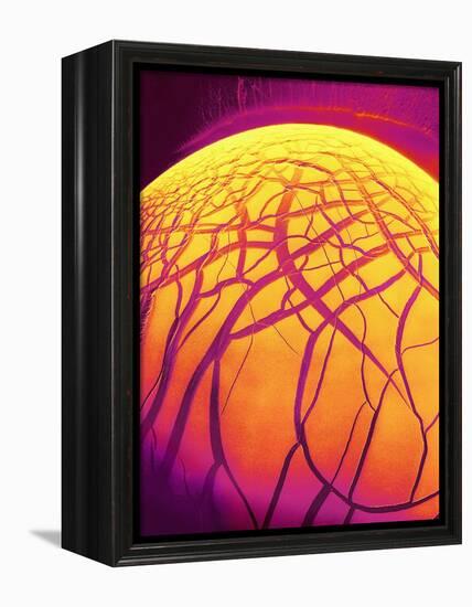 Dryed Drop of Blood-Micro Discovery-Framed Premier Image Canvas