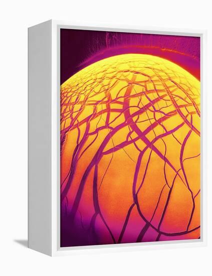 Dryed Drop of Blood-Micro Discovery-Framed Premier Image Canvas