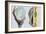 E. Coli Food Poisoning-Tim Vernon-Framed Photographic Print