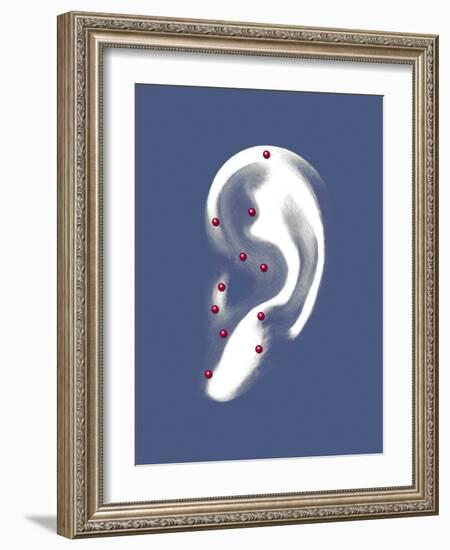 Ear Acupuncture, Artwork-Mikkel Juul-Framed Photographic Print
