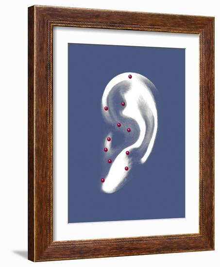 Ear Acupuncture, Artwork-Mikkel Juul-Framed Photographic Print