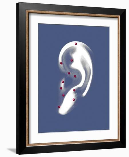 Ear Acupuncture, Artwork-Mikkel Juul-Framed Photographic Print