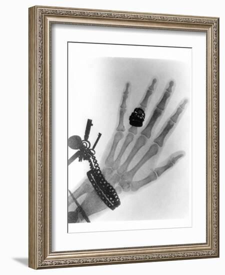 Early X-ray Photograph of a Hand Taken In 1896-Science Photo Library-Framed Photographic Print