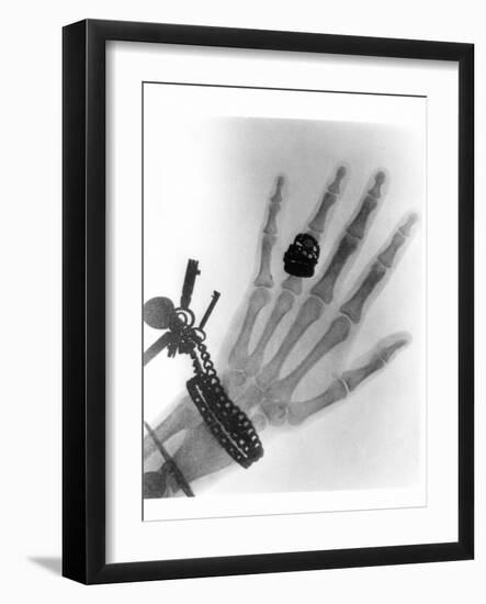 Early X-ray Photograph of a Hand Taken In 1896-Science Photo Library-Framed Photographic Print