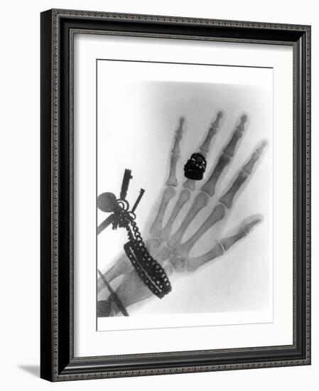 Early X-ray Photograph of a Hand Taken In 1896-Science Photo Library-Framed Photographic Print