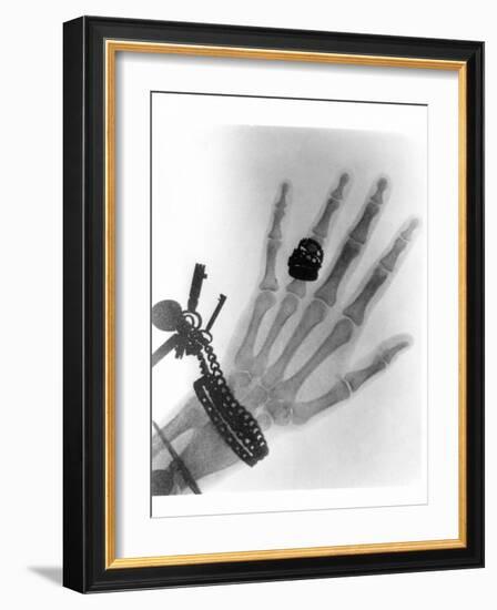 Early X-ray Photograph of a Hand Taken In 1896-Science Photo Library-Framed Photographic Print