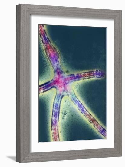 Ebola Virus Replication, TEM-null-Framed Photographic Print