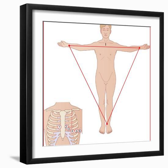 ECG Electrode Placement, Artwork-Peter Gardiner-Framed Premium Photographic Print