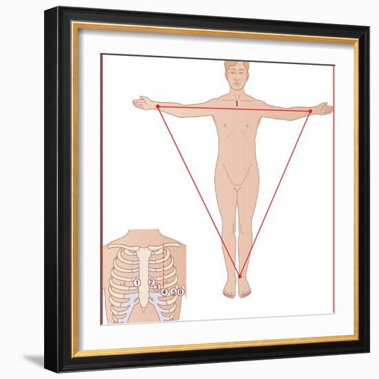 ECG Electrode Placement, Artwork-Peter Gardiner-Framed Premium Photographic Print