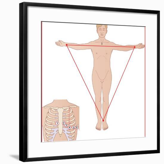 ECG Electrode Placement, Artwork-Peter Gardiner-Framed Photographic Print