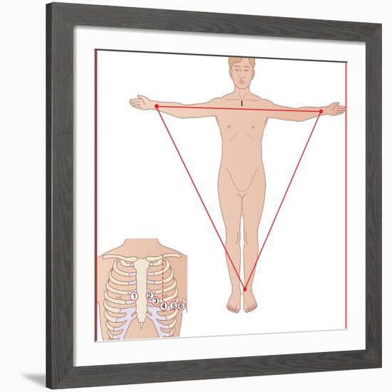 ECG Electrode Placement, Artwork-Peter Gardiner-Framed Photographic Print