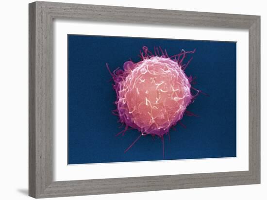 Embryonic Stem Cell, SEM-Science Photo Library-Framed Photographic Print