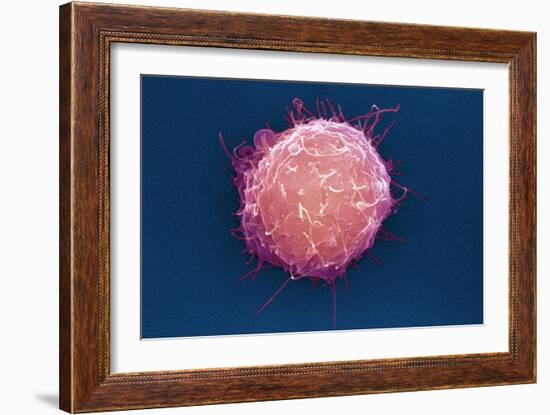 Embryonic Stem Cell, SEM-Science Photo Library-Framed Photographic Print