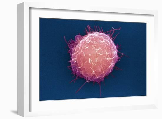 Embryonic Stem Cell, SEM-Science Photo Library-Framed Photographic Print