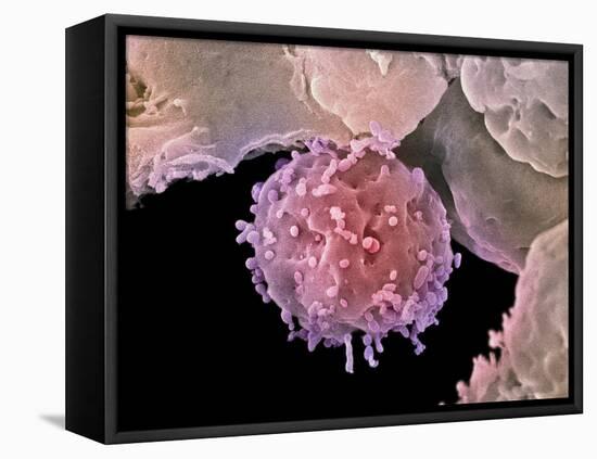Embryonic Stem Cells, SEM-Steve Gschmeissner-Framed Premier Image Canvas