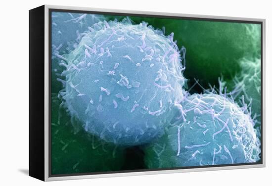 Embryonic Stem Cells, SEM-Science Photo Library-Framed Premier Image Canvas